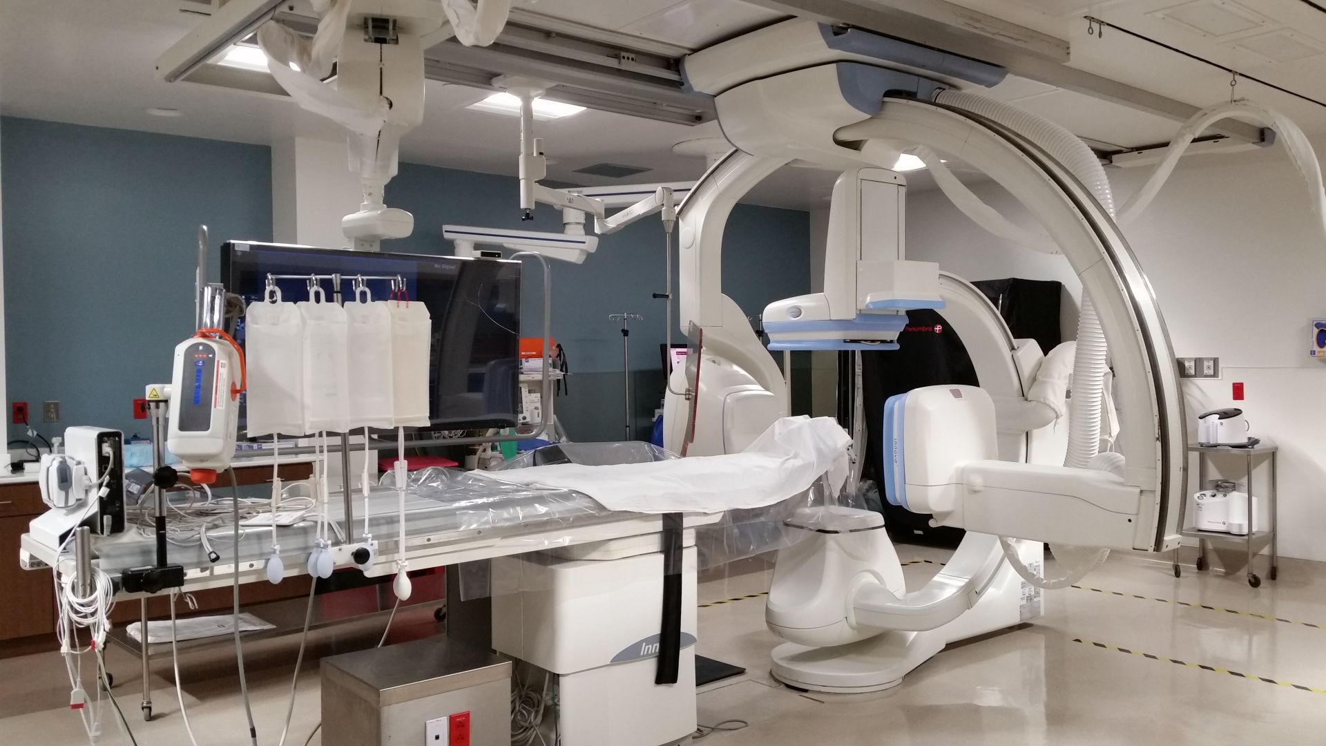 Stroke treatment